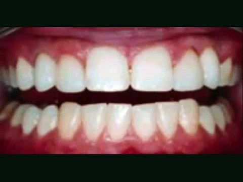 Cosmetic Dental Surgery : Beautiful results affordable dentistry