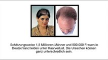 Kreisrunder Haarausfall - Alopecia Areata, Alopecia Areata Behandlung