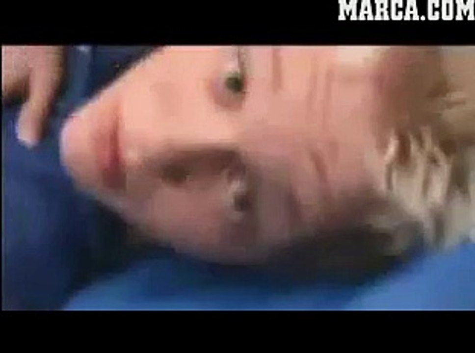 Un gimnasta se rompe la pierna