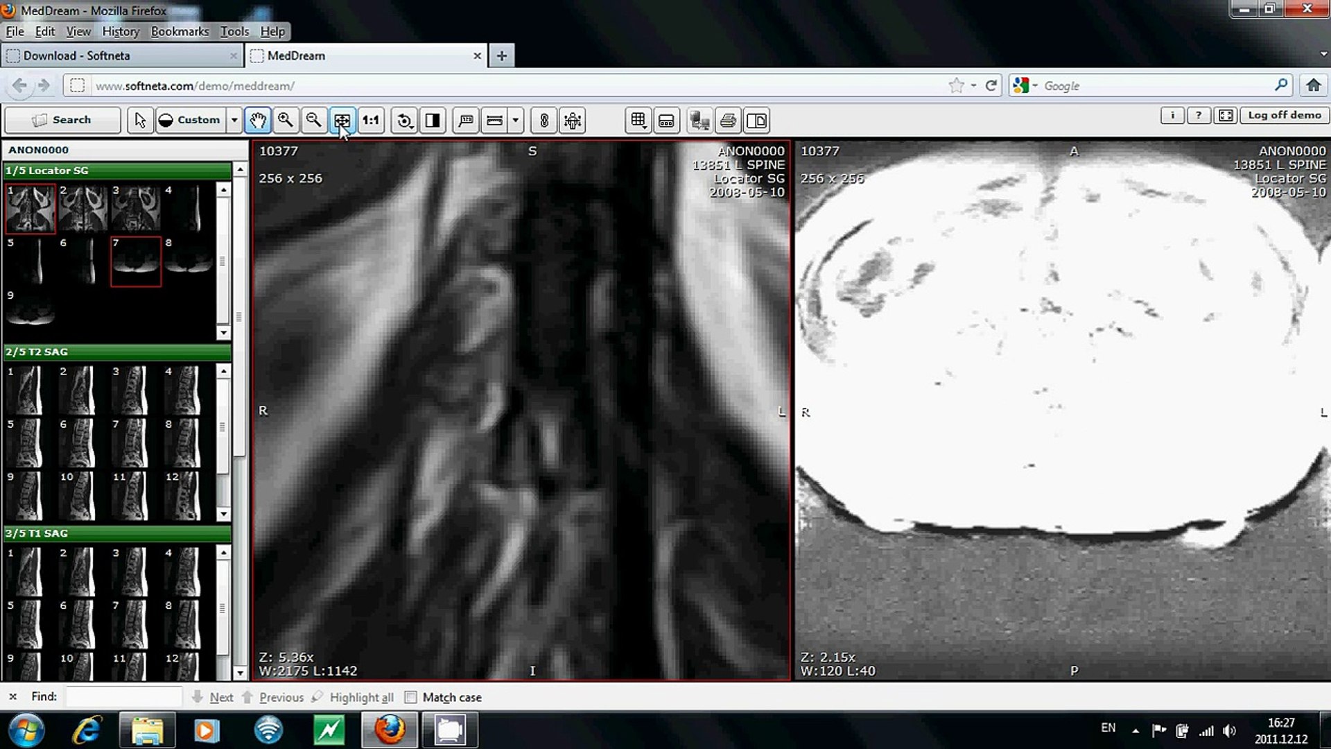 Osirix dicom viewer crack free