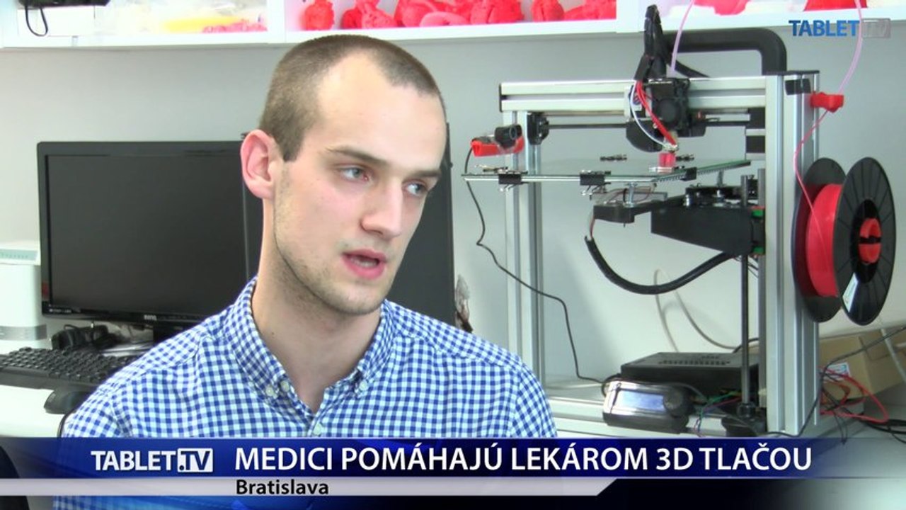 Medici z Bratislavy pomáhajú lekárom 3D tlačou modelov