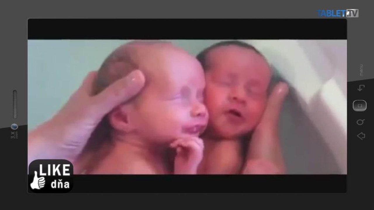 LIKE DŇA: Dvojičky si mysleli, že sú ešte v brušku
