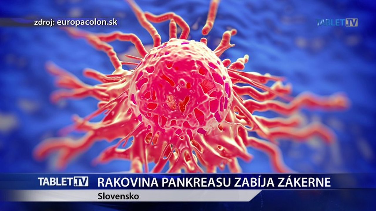 Rakovinu pankreasu nájdu lekári neskoro, väčšina pacientov zomiera 