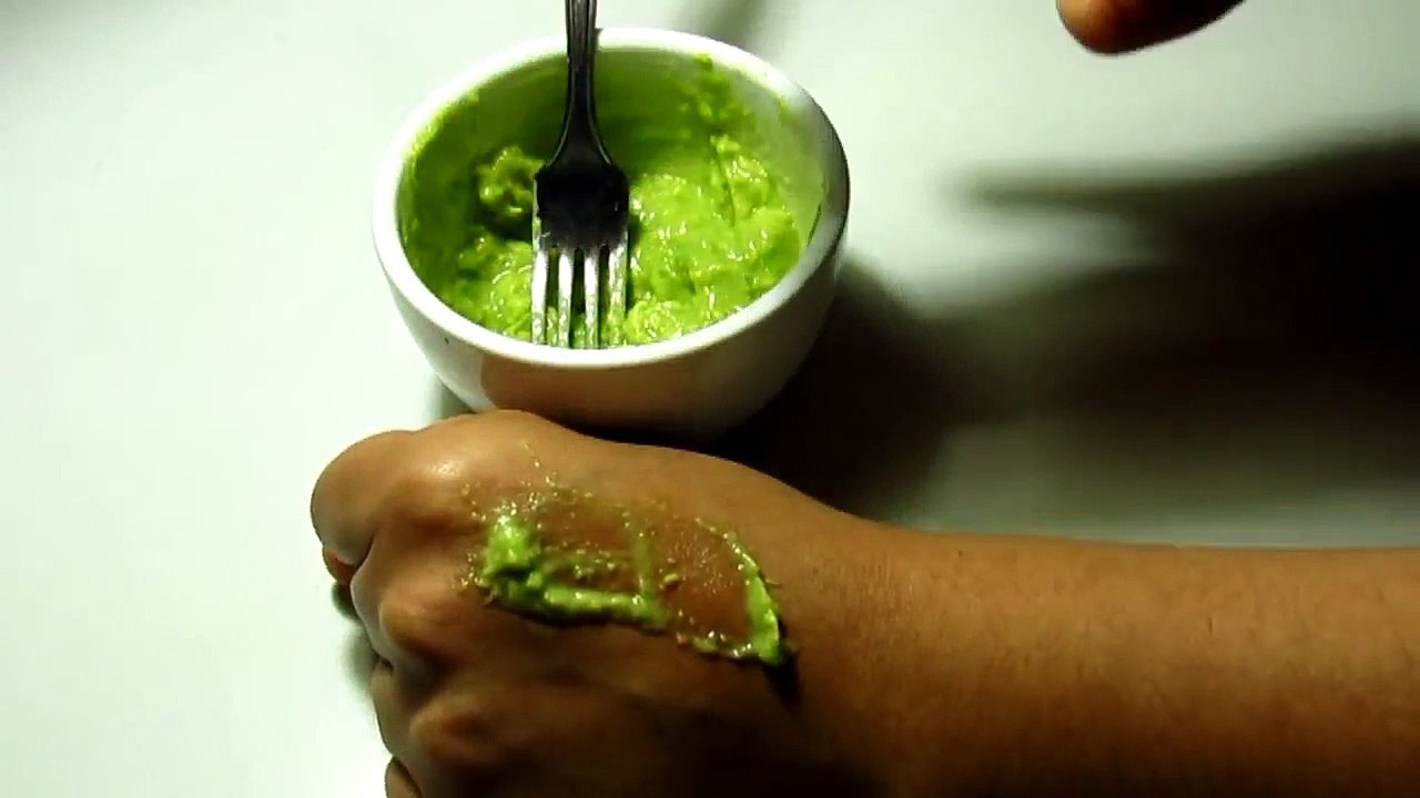 Remedios caseros para las estrias