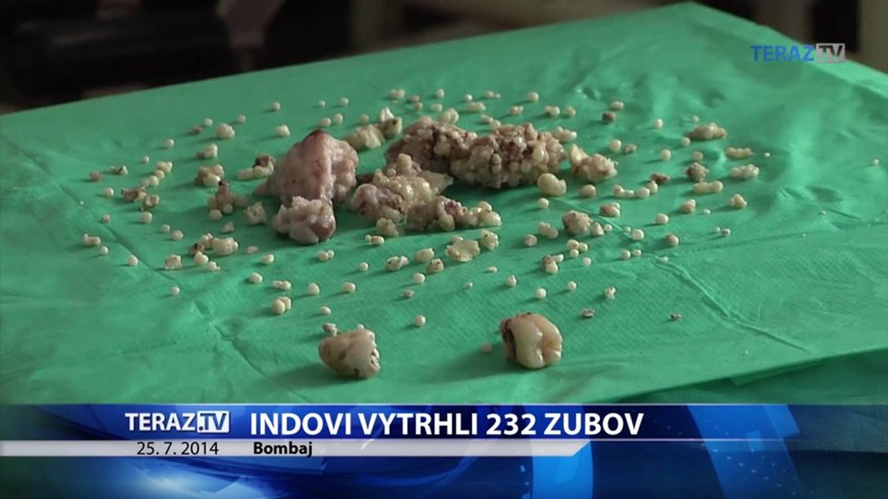 Chlapcovi vytrhli 232 zubov a ešte stále mu nejaké ostali