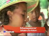 Madagascar Malnutrition