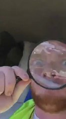 Guy Burns Unsuspecting Friend With Magnifying Glass And His Reaction Is Priceless