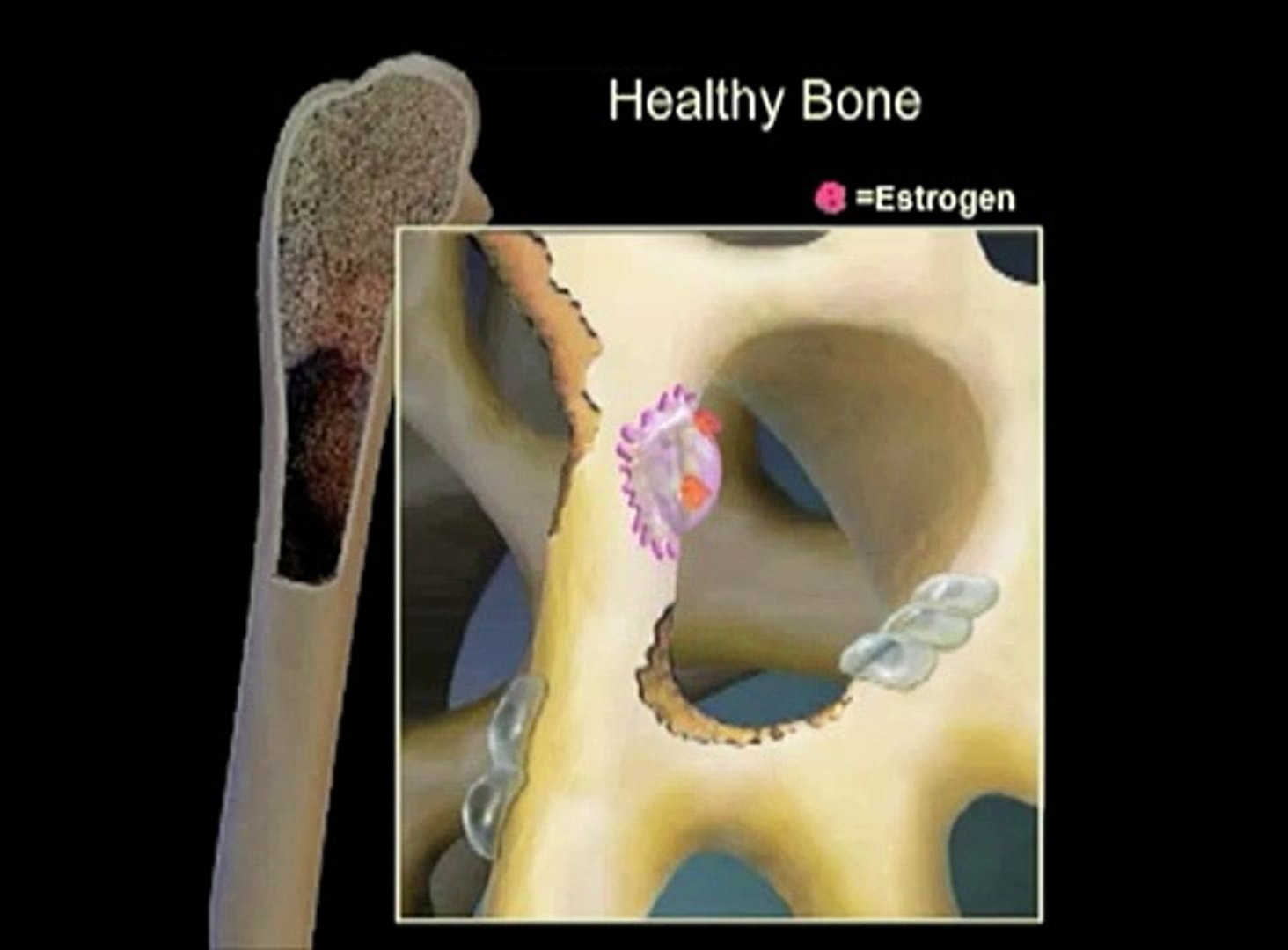 Protecting the Bone During Cancer