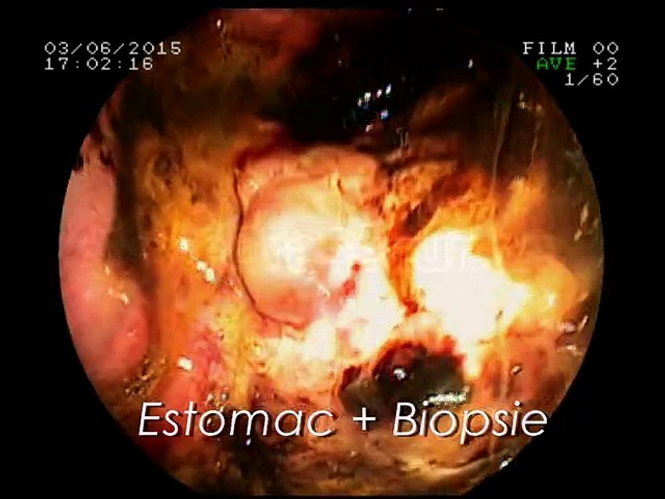 Adénocarcinome gastrique - Clinique vétérinaire Brasseur