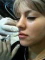 Makeover Competition, lip augmentation and dermal fillers Sydney face rejuvenation clinic