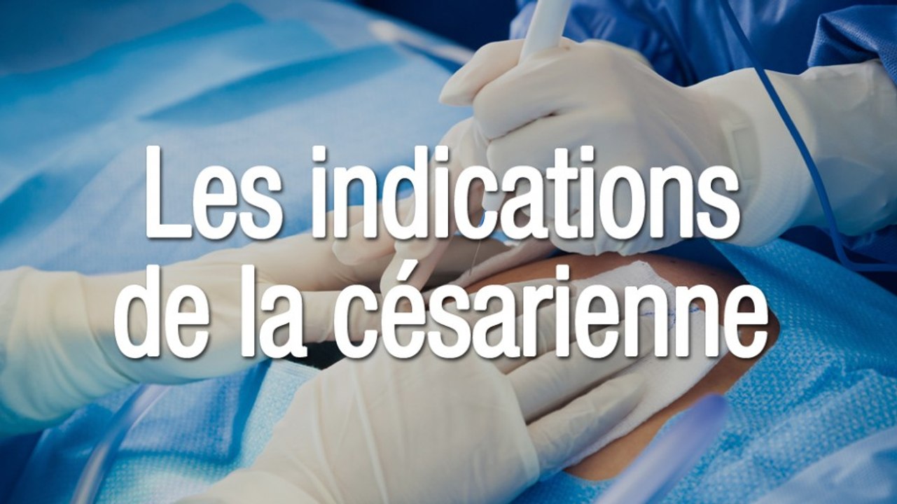 Les indications de la césarienne