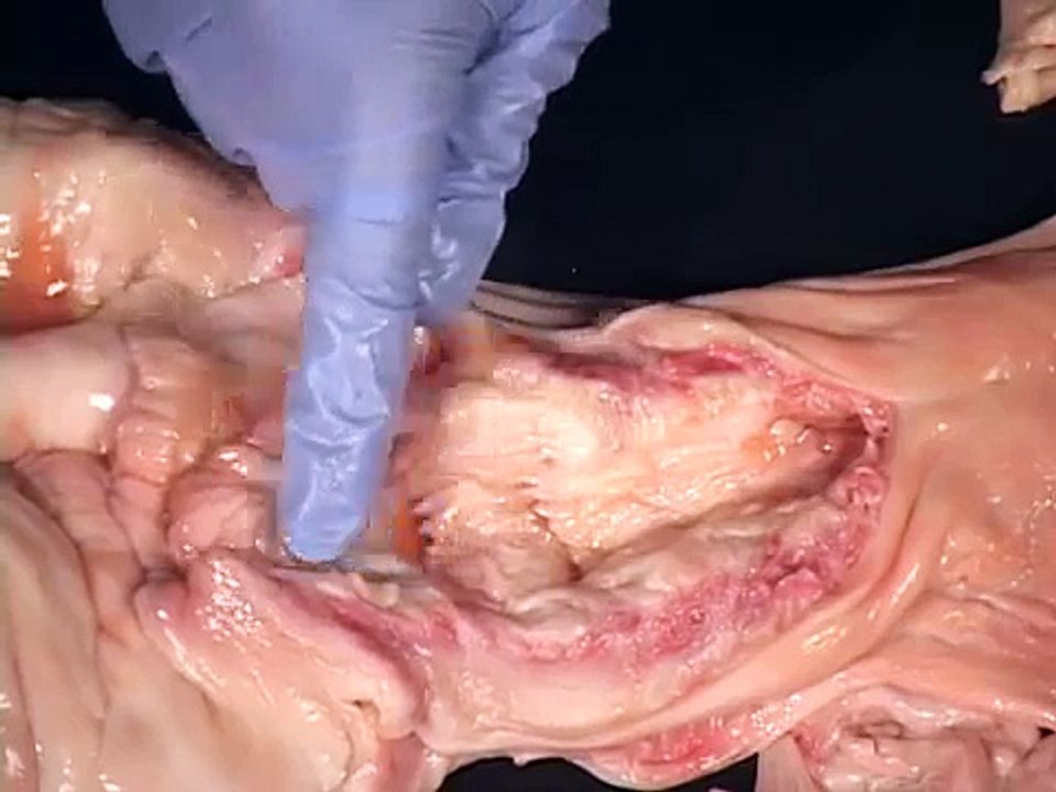 Reproductive Anatomy of the cow
