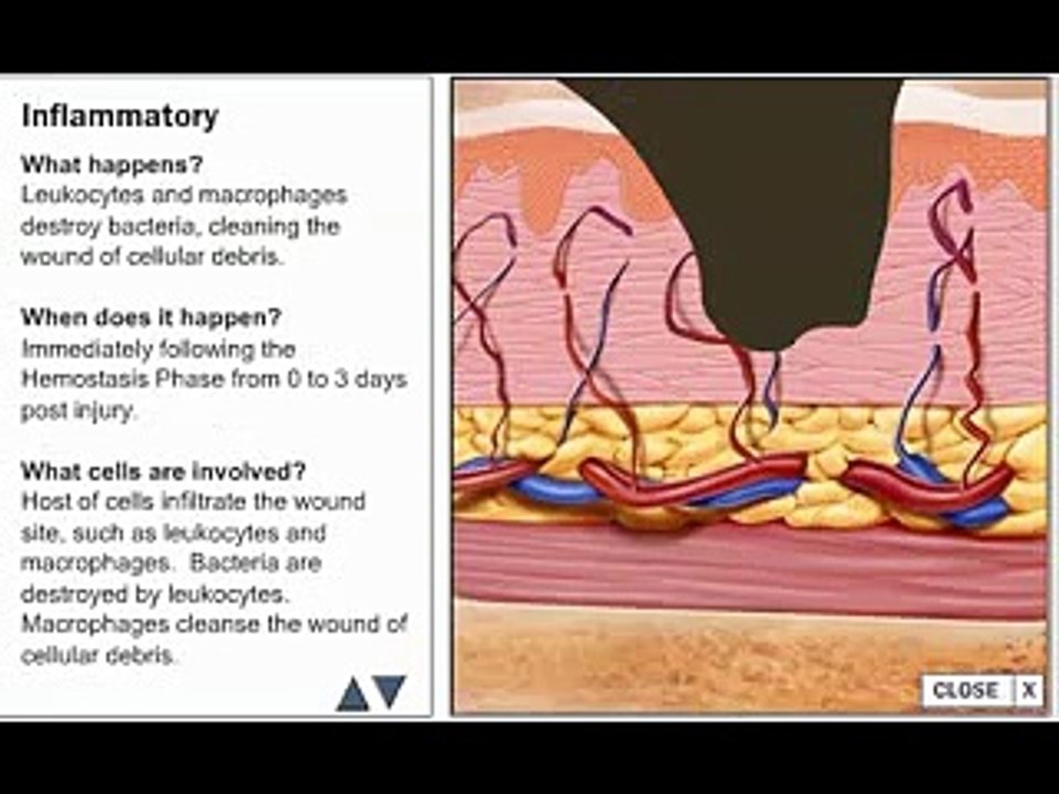wound healing process.flv