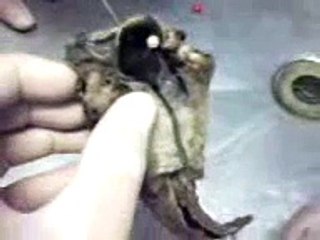 Sistema respiratório - anatomia da laringe