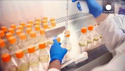 Alzheimer: un farmaco sperimentale è in grado di rallentare la malattia