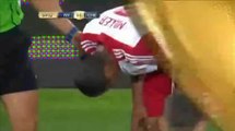 Roy Miller gets Injured | NY Red Bulls vs Chelsea International Champions Cup 2015 HD