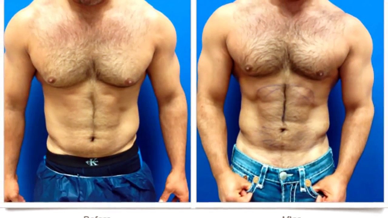 Adonis Golden Ratio - Achieve The Perfect Body Shape