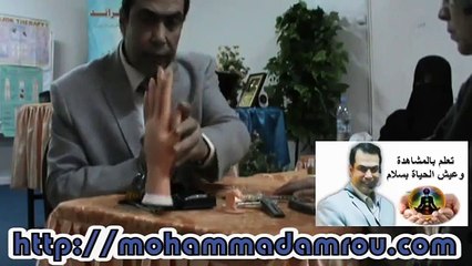 سوجوك علاج الظهر ـ محمد رضى عمرو