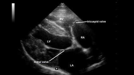 Echo canine ECG Right parasternal long axis