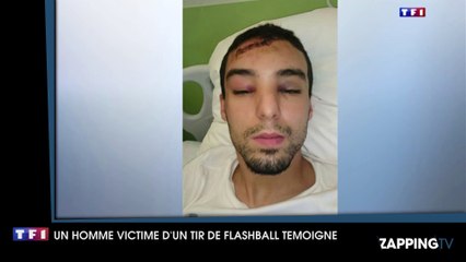 Témoignage glaçant d'un jeune homme blessé par le tir de Flash-Ball d'un policier