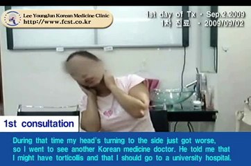 Treatment case of Torticollis (cervical dystonia)