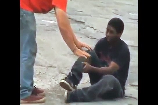 BMX Rider Surprisingly Chill About Horribly Broken Leg