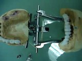 Zirkon Zahn teeth,Dental Lab