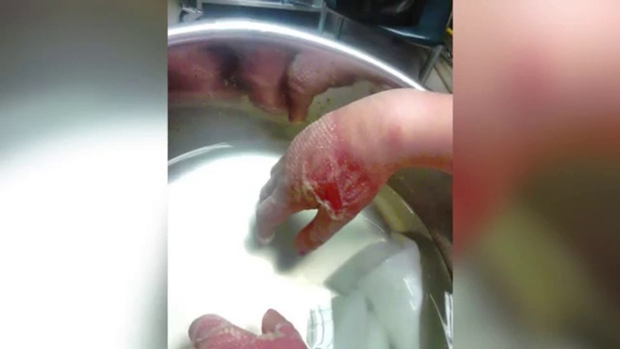 Elle trouvait la plante jolie, elle a voulu la toucher et elle n'aurait pas du!