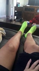 Patella fracture  rehabilitation quad strengthening