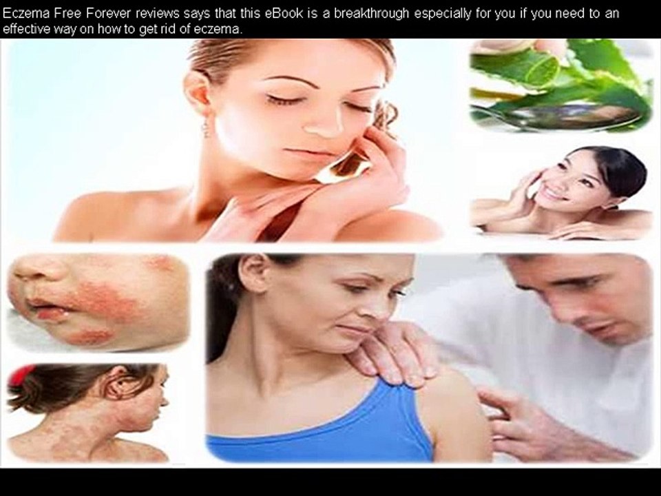 Eczema Free Forever Review
