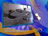 Emergencia sanitaria por epidemia de TBC multidrogo resistente