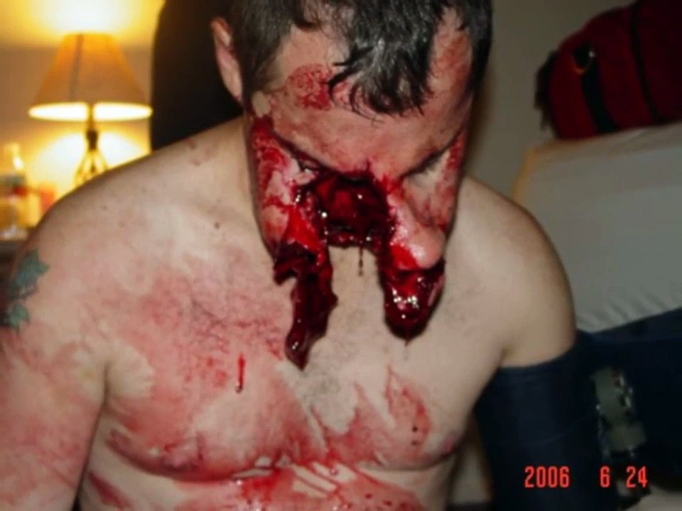 ESPAÇO DOENÇA - Hidrofobia