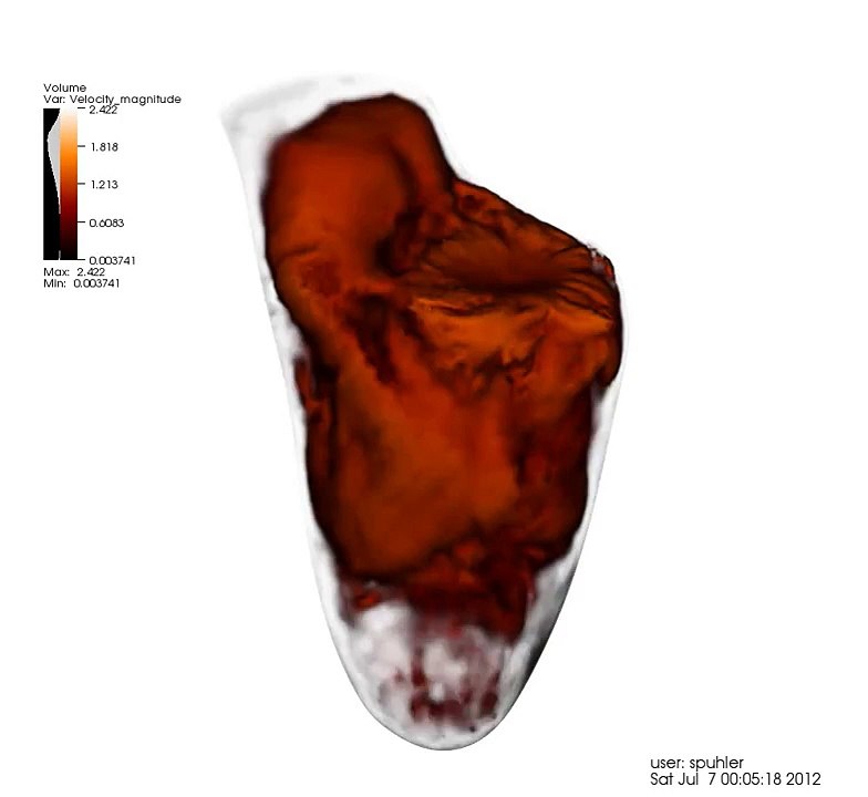 Simulation of blood flow in the heart