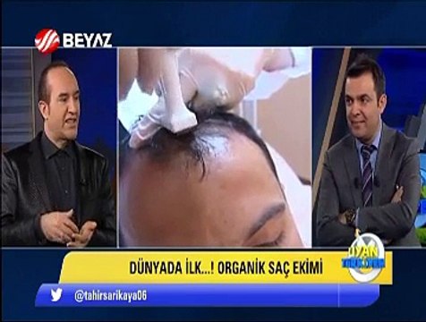 Organik saç ekimi yapan kel doktor