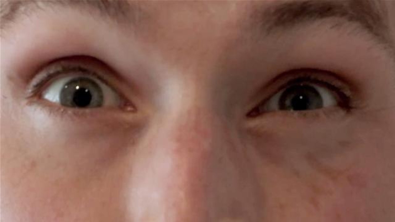 Staring Contest