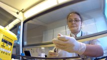 Leucémie Myéloïde Chronique : prélèvement de moelle, biologie moléculaire et LMC