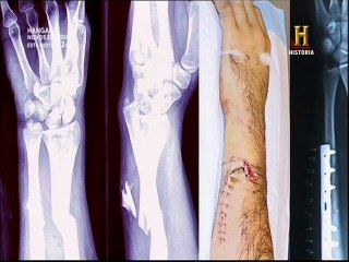 A História Encantada, #4 - As Almas Perdidas de Pennhurst - Haunted History, Lost Souls of Pennhurst - História
