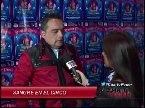 Circo de la Paisana Jacinta: así terminó la pierna de 'Yuca'