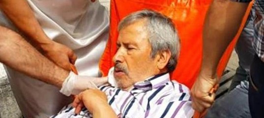 Yolda yürürken yere düştü yüzüne demir saplandı