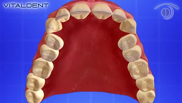 Vitaldent Castellón: ¿Qué es la ortopedia dentofacial infantil?