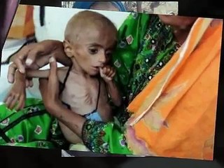 Antonio De Santis: Fame e povertà, non dimentichiamoci dei fratelli più sfortunati.