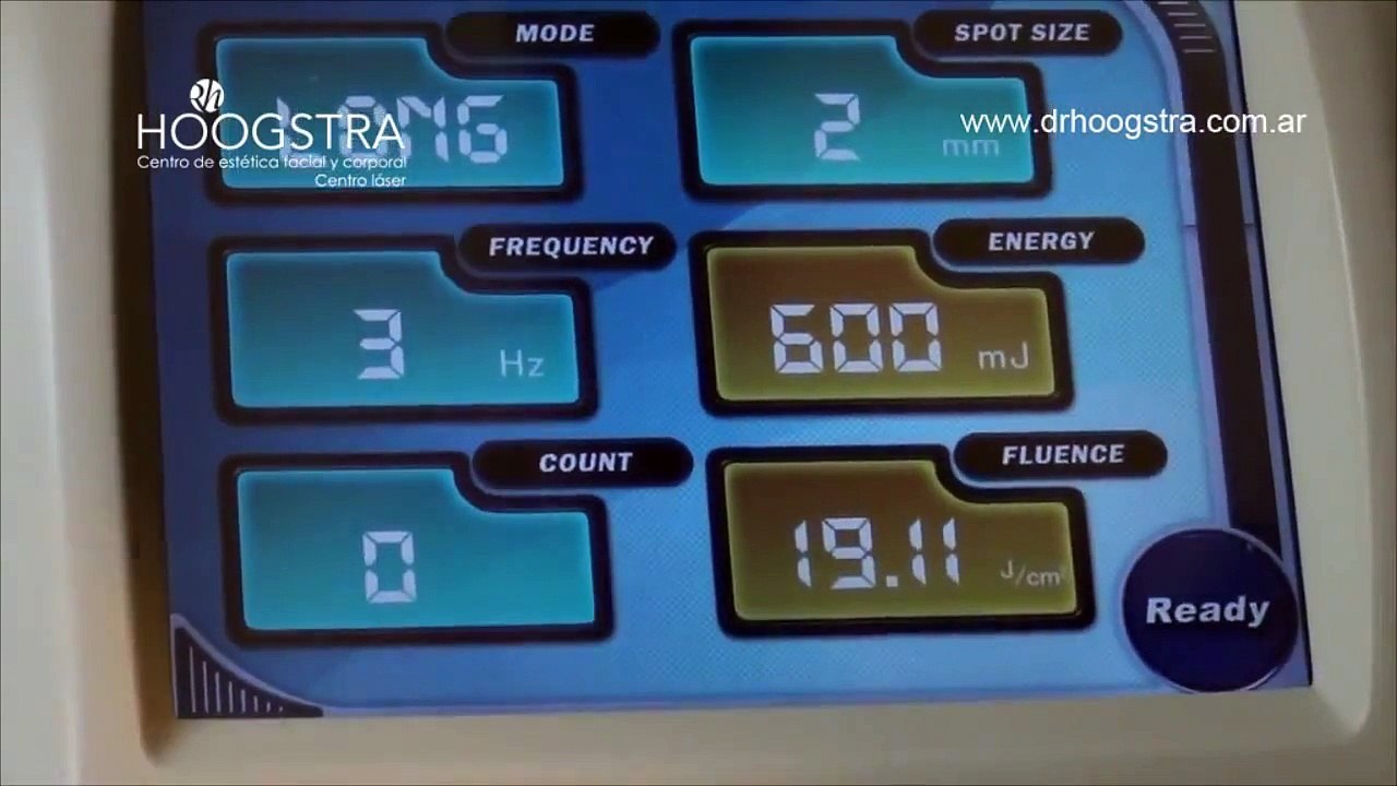 Extracción de Quiste Sebáceo con Láser Lotus II (14080)