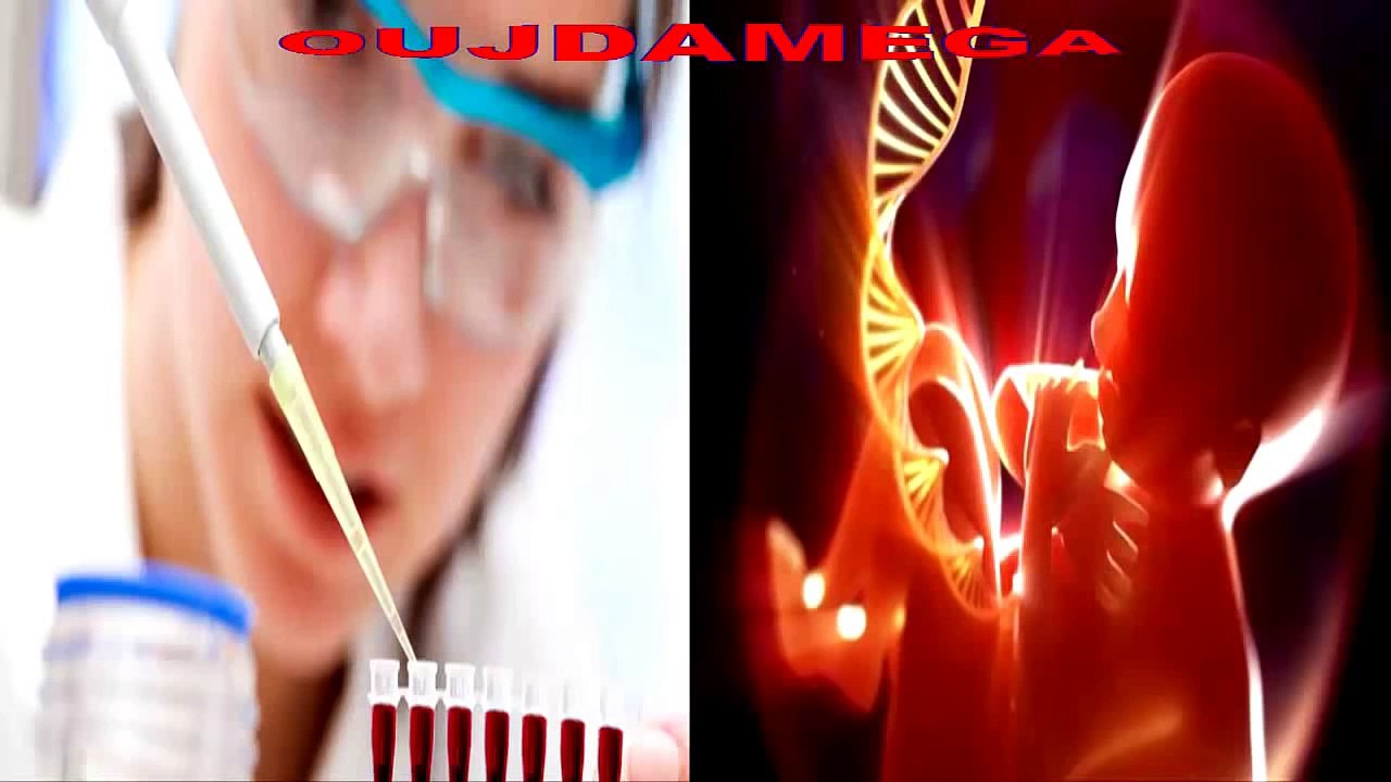 ► ღ♥ღ CHEB HASNI - ADN ( قضية اثبات نسب ) ღ♥ღ