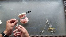 Modified Intraoral Suturing Technique - Surgical Knot Tying