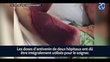 Un selfie avec un serpent lui coûte 140.000 euros de soin