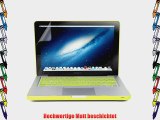 GMYLE Neon Gelb 4 in 1 H?lle Tasche f?r Macbook Pro 13 Zoll - Weicher Transportbeutel - Tastatur-Abdeckung