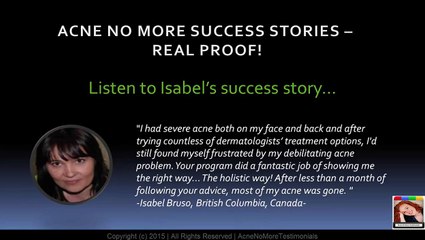 Acne No More Review - Isabel's Acne No More Success Story - Part 2