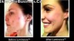 Jeunesse Global LUMINESCE™  BEFORE & AFTER RESULTS