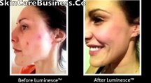 Jeunesse Global LUMINESCE™  BEFORE & AFTER RESULTS