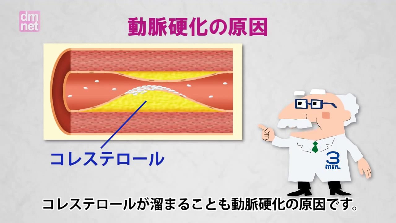 5-5. 動脈硬化（大血管症）【糖尿病３分間ラーニング】